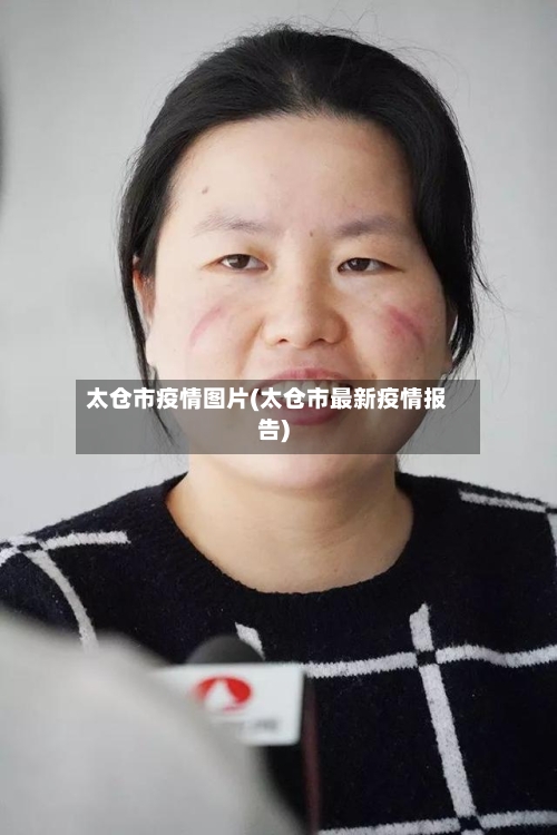 太仓市疫情图片(太仓市最新疫情报告)