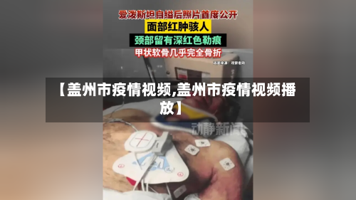 【盖州市疫情视频,盖州市疫情视频播放】
